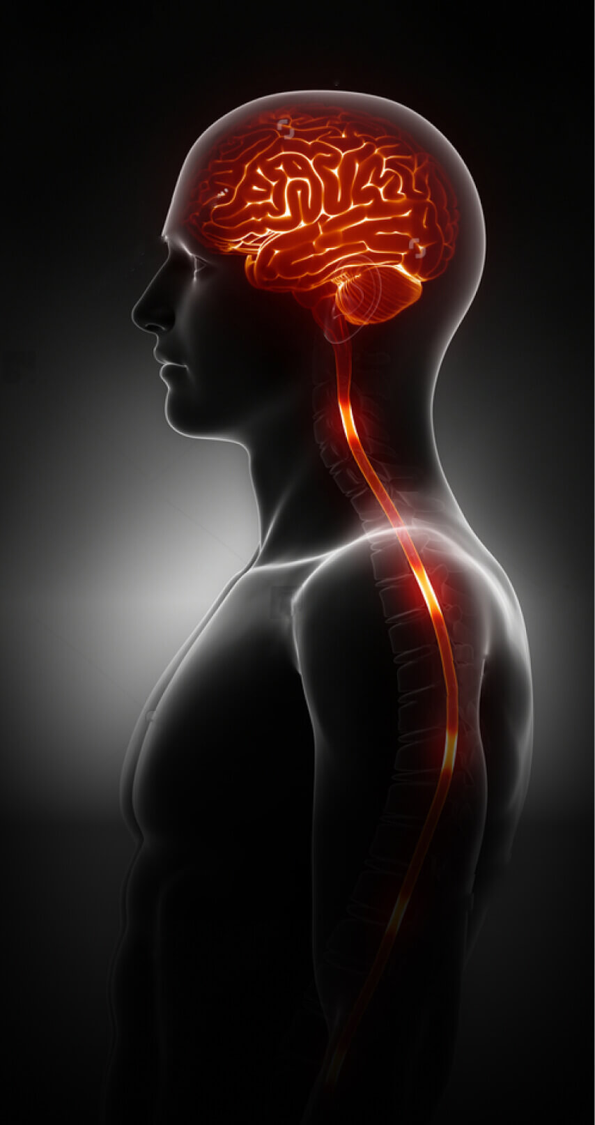 Lawyers Specialized in Catastrophic Brain and Spinal Cord Injuries